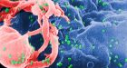 HIV variant discovered in Netherlands | CTV News