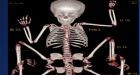 Indian girl born with eight limbs conscious