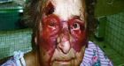 Two seniors beaten in BC nursing home