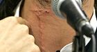 OHL players protest neck-guard rule on Facebook