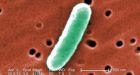 E. coli cases in Guelph probed for links