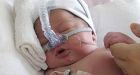 Baby Lillian gets heart transplant
