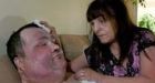 B.C. man ready to die 21 years after suffering burns
