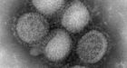 3 more swine flu deaths in B.C.