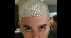 The brave man�s solution to baldness