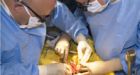 Full intestinal transplant completed in Australia