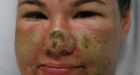 Wash. woman threw acid on self: police