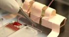 New blood test helps spot migrating cancer cells