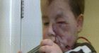 Little Maddox released from New York hospital