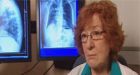 Extreme tuberculosis raises alarms in Canada