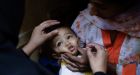 Canada to allocate $250 million for global fight against polio
