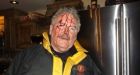 Owl viciously attacks rabbit hunter near Digby, N.S.