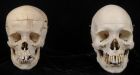 3 human skulls donated to Seattle-area thrift shop