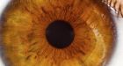 Keep contact lenses clean, doctors warn after amoeba eats through eyeballs