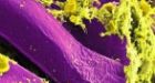 Plague outbreak in Madagascar kills 40 people since late August, WHO reports