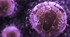 HIV evolving 'into milder form'