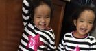 Father of ailing twins can only donate his liver to one of them