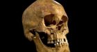 Richard III skull reveals king's death blow, pathologists say