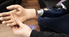 3 Austrian men first to get mind-controlled bionic hands after amputation