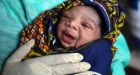 Ebola-sapped West African countries now face serious measles risk